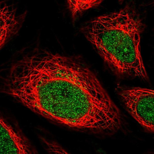 IFNGR2 Antibody in Immunocytochemistry (ICC/IF)