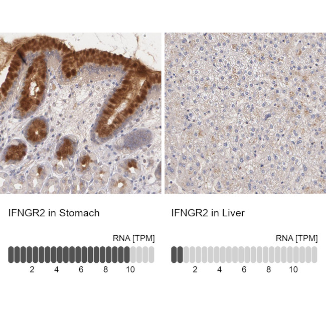 IFNGR2 Antibody in Immunohistochemistry (IHC)