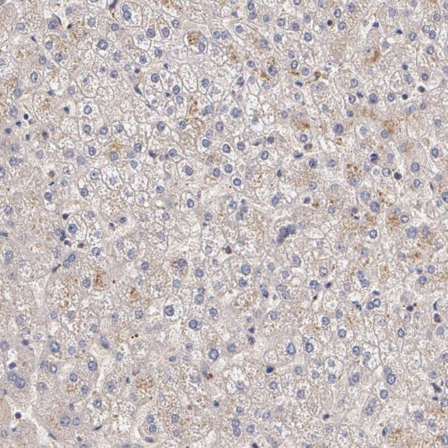 IFNGR2 Antibody in Immunohistochemistry (IHC)