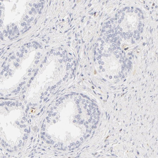 Carbonic Anhydrase II Antibody in Immunohistochemistry (IHC)