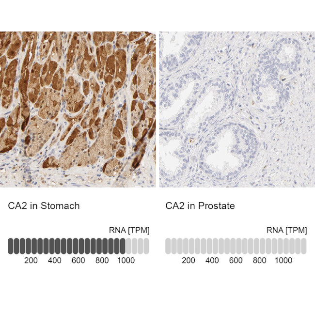 Carbonic Anhydrase II Antibody