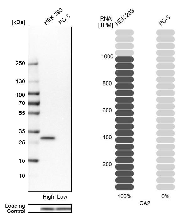 Carbonic Anhydrase II Antibody