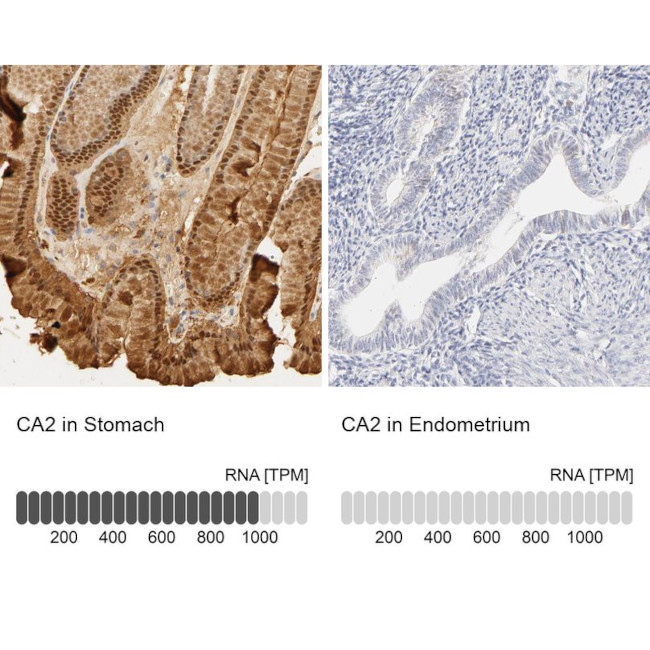 Carbonic Anhydrase II Antibody