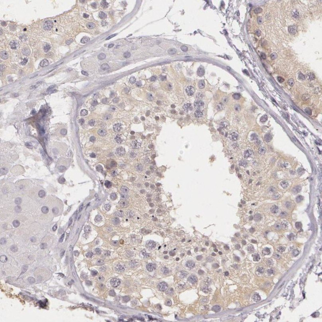 G2E3 Antibody in Immunohistochemistry (IHC)