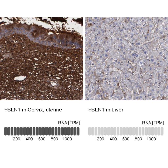 Fibulin 1 Antibody in Immunohistochemistry (IHC)