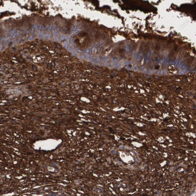 Fibulin 1 Antibody in Immunohistochemistry (IHC)