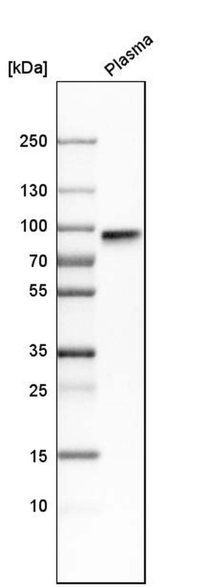 Fibulin 1 Antibody in Western Blot (WB)