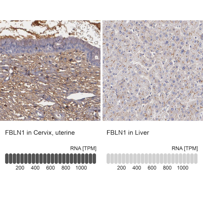 Fibulin 1 Antibody in Immunohistochemistry (IHC)