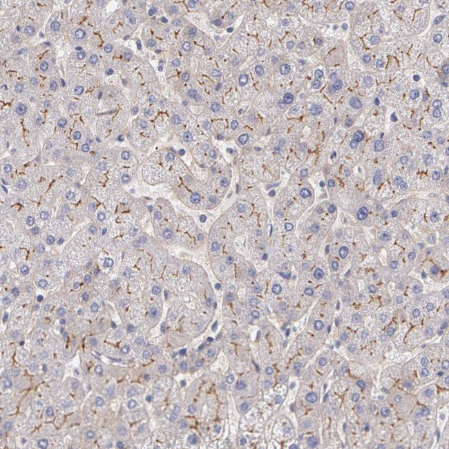 Fibulin 1 Antibody in Immunohistochemistry (IHC)