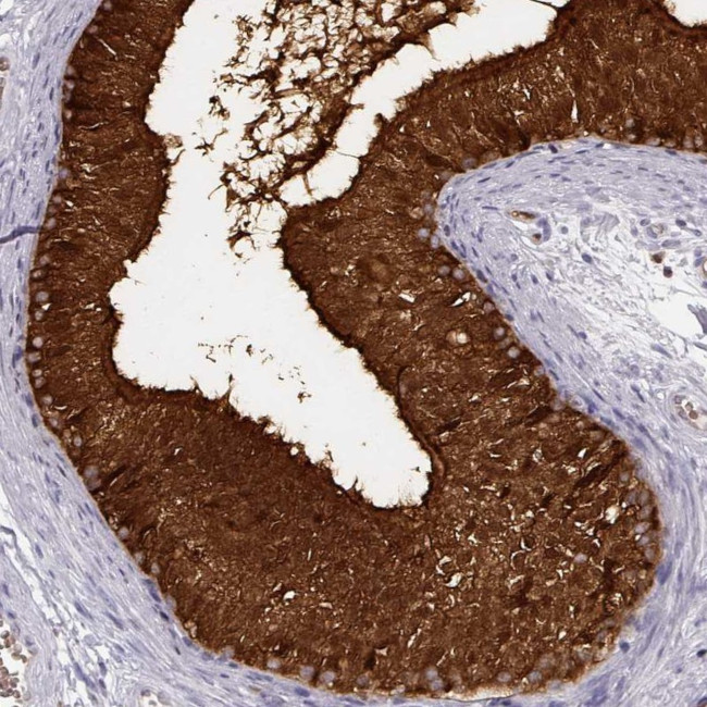 PNP Antibody in Immunohistochemistry (IHC)