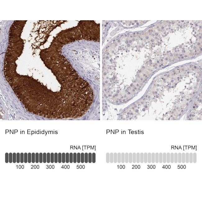 PNP Antibody