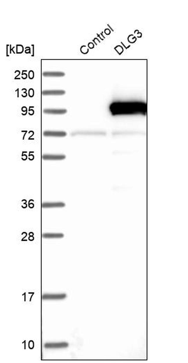 SAP102 Antibody in Western Blot (WB)