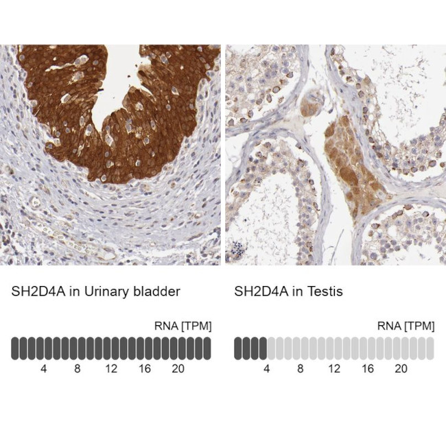 SH2D4A Antibody in Immunohistochemistry (IHC)