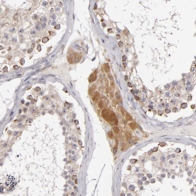 SH2D4A Antibody in Immunohistochemistry (IHC)