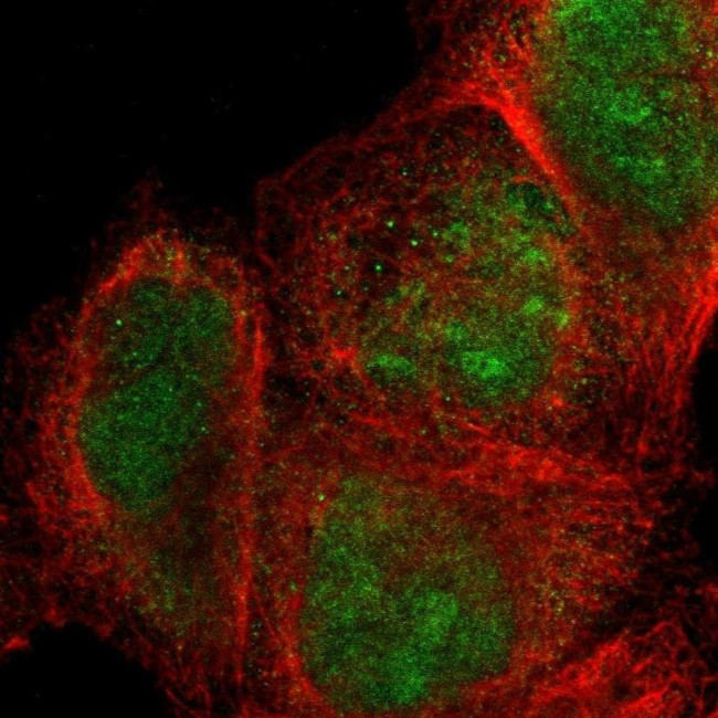 SIX1 Antibody in Immunocytochemistry (ICC/IF)