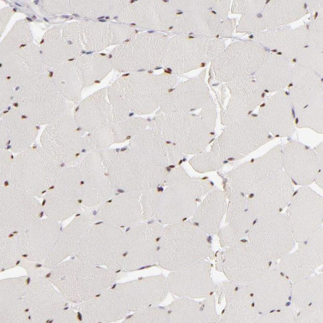 SIX1 Antibody in Immunohistochemistry (IHC)