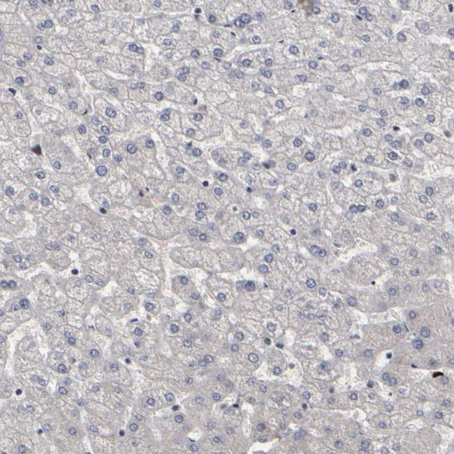 ATRX Antibody in Immunohistochemistry (IHC)