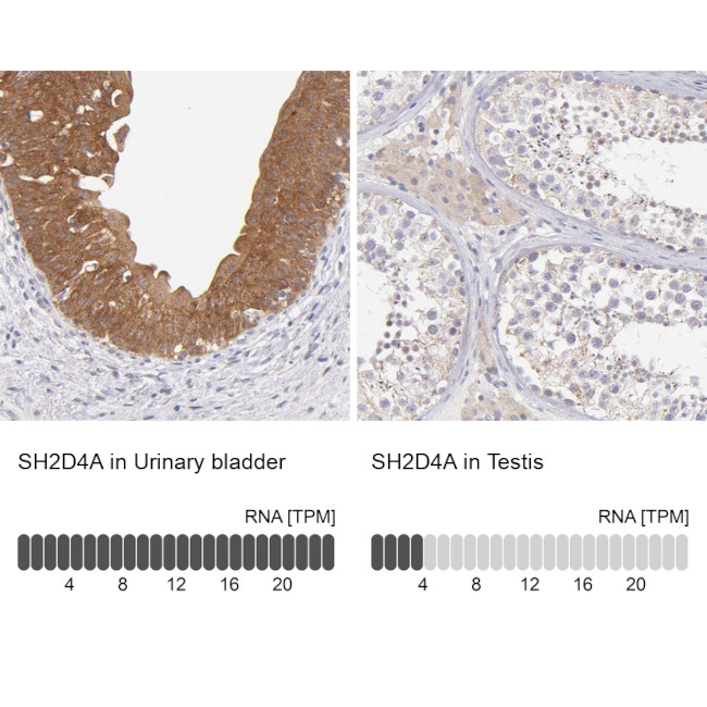 SH2D4A Antibody