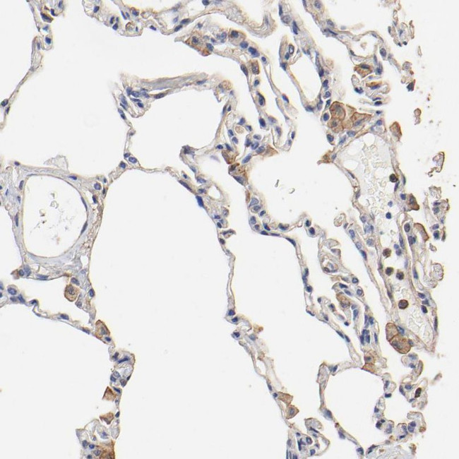 TAGLN2 Antibody in Immunohistochemistry (IHC)