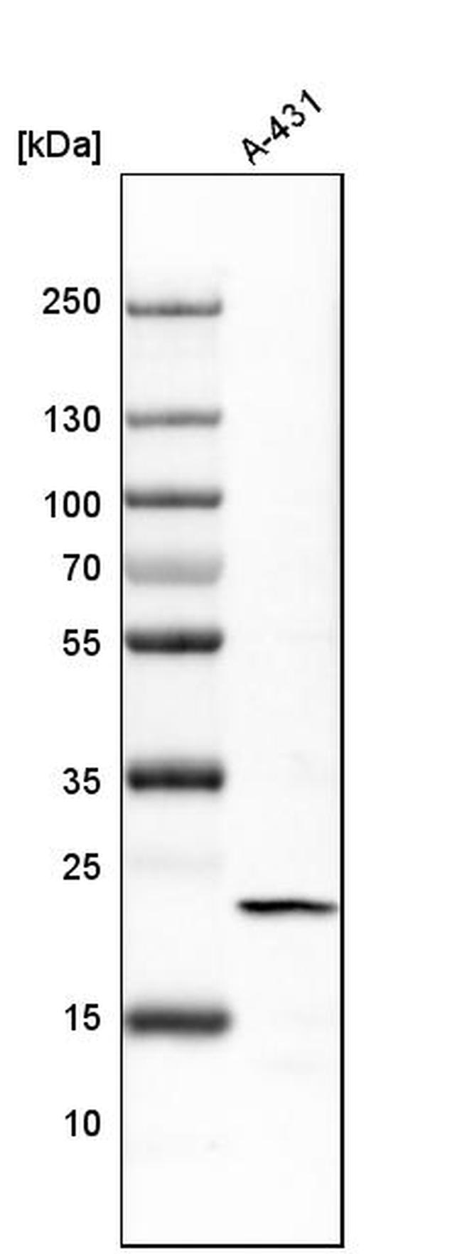 TAGLN2 Antibody in Western Blot (WB)