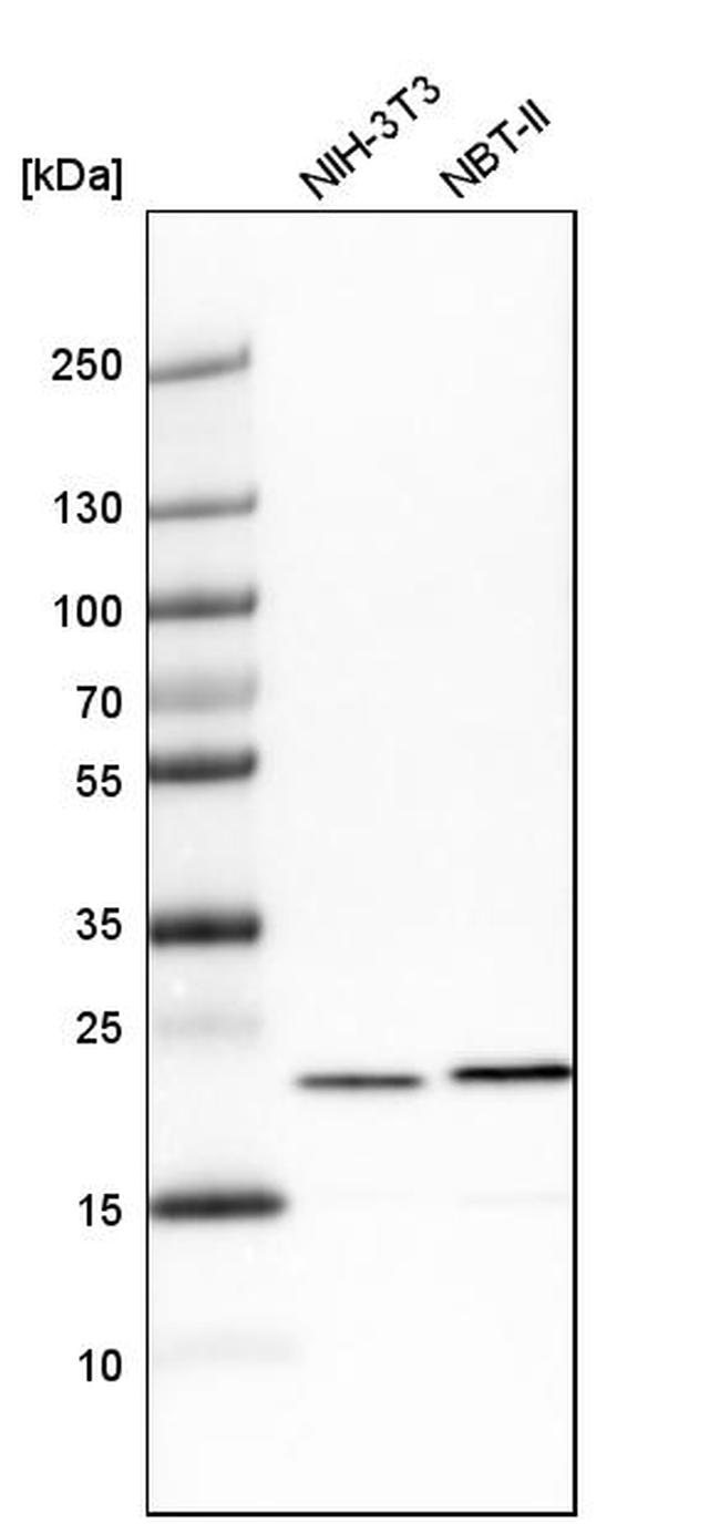 TAGLN2 Antibody in Western Blot (WB)