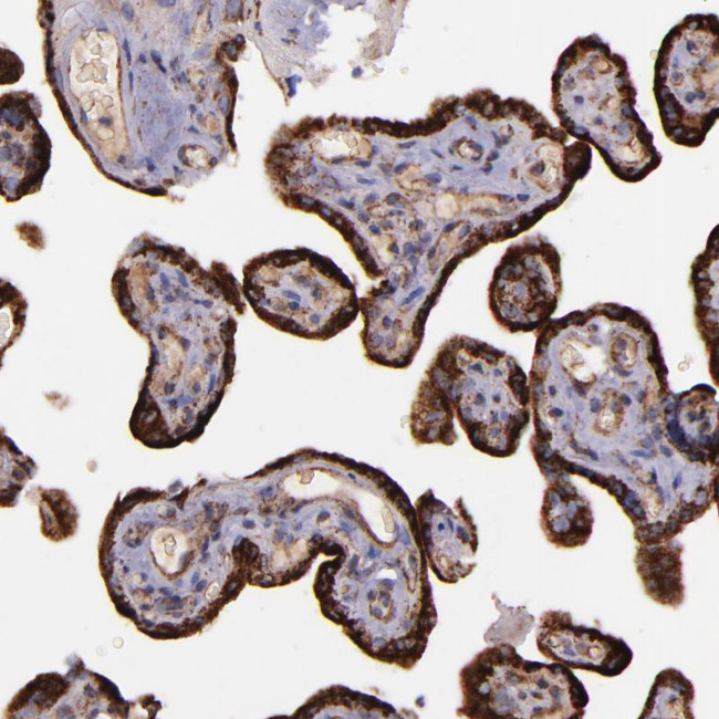 IDH3G Antibody in Immunohistochemistry (IHC)