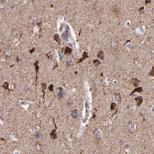 IDH3G Antibody in Immunohistochemistry (IHC)