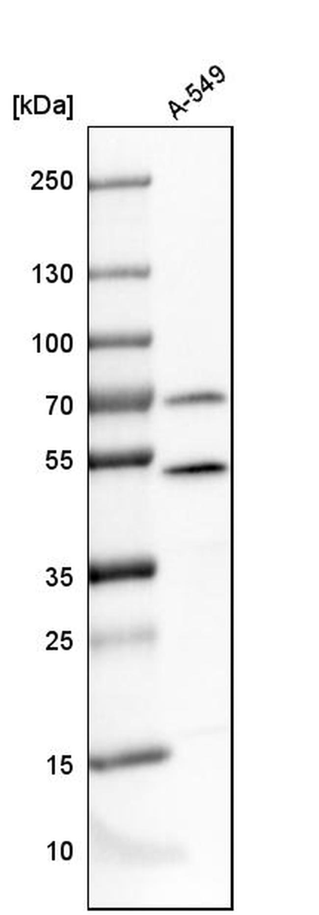 PSMC4 Antibody in Western Blot (WB)