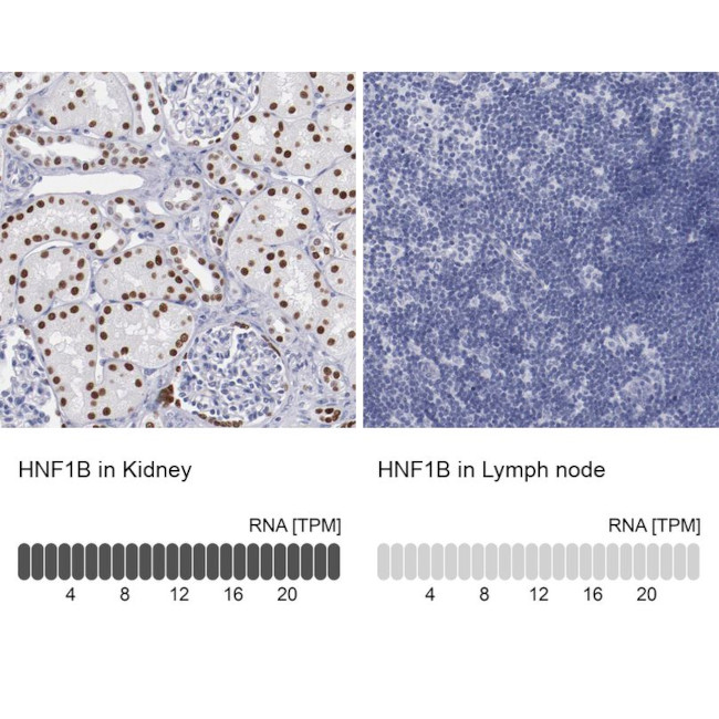 TCF2 Antibody