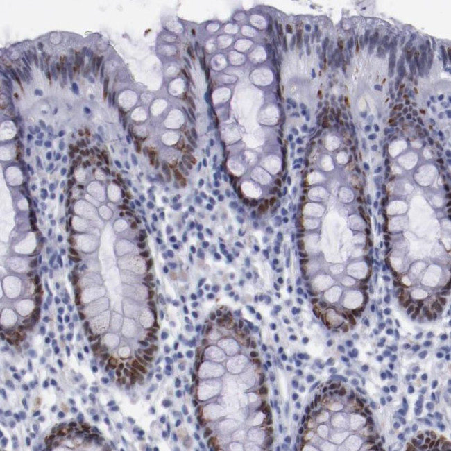 TCF2 Antibody in Immunohistochemistry (IHC)