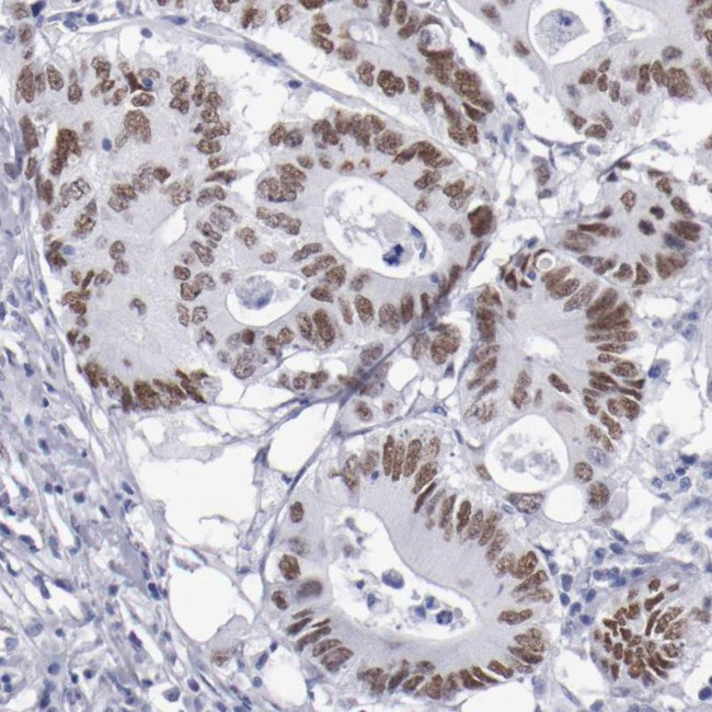 TCF2 Antibody in Immunohistochemistry (IHC)