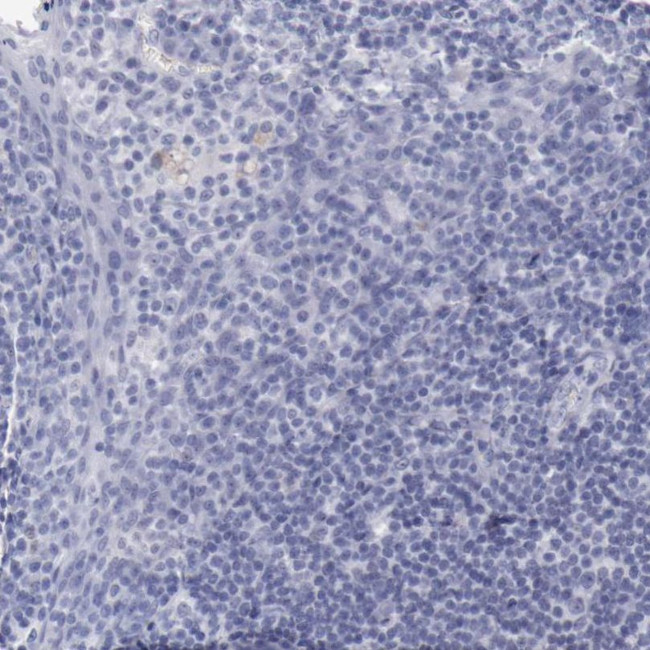 TCF2 Antibody in Immunohistochemistry (IHC)