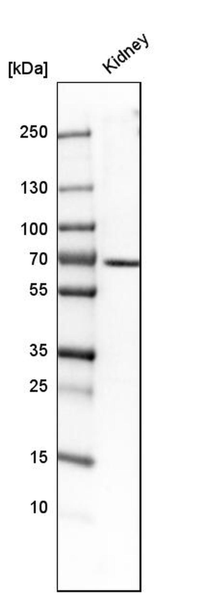 TCF2 Antibody in Western Blot (WB)