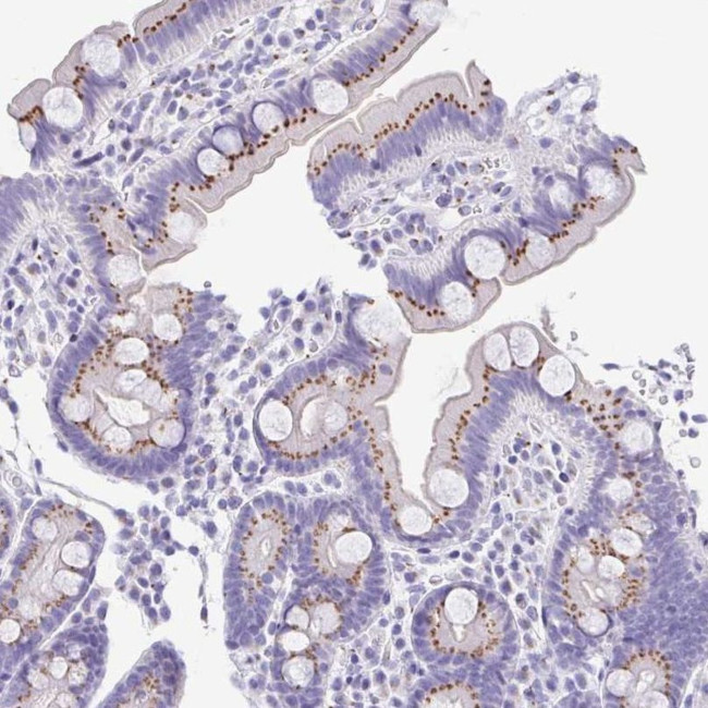 SULT1B1 Antibody in Immunohistochemistry (IHC)