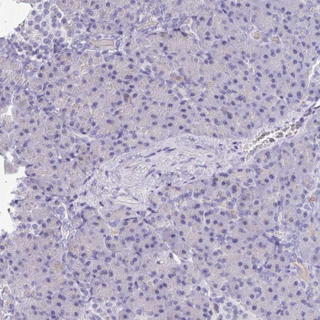 SULT1B1 Antibody in Immunohistochemistry (IHC)