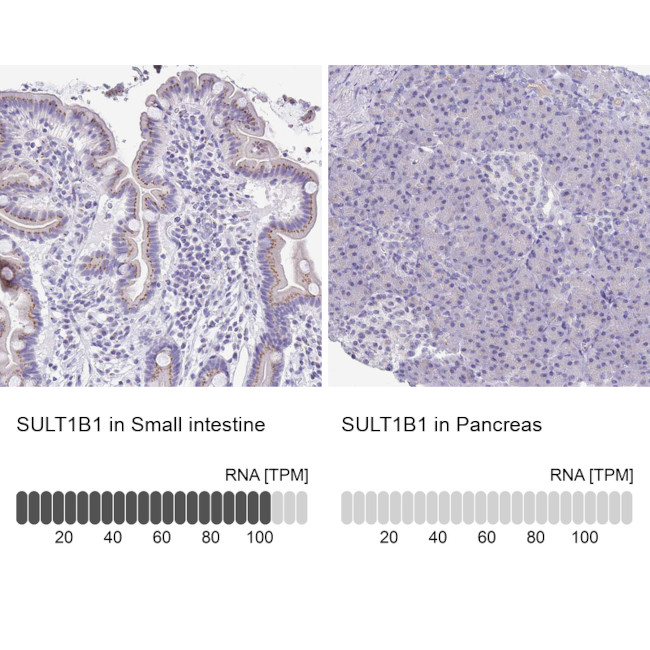 SULT1B1 Antibody