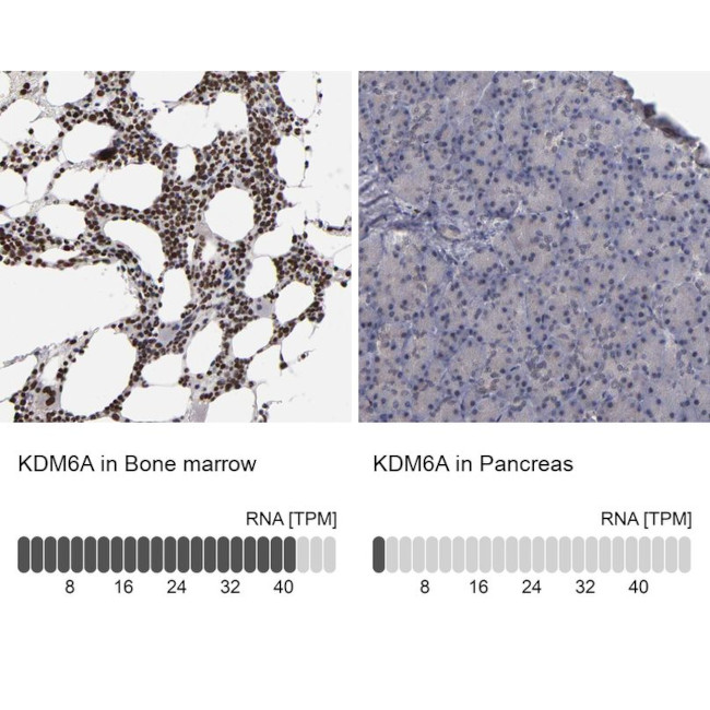 KDM6A Antibody in Immunohistochemistry (IHC)
