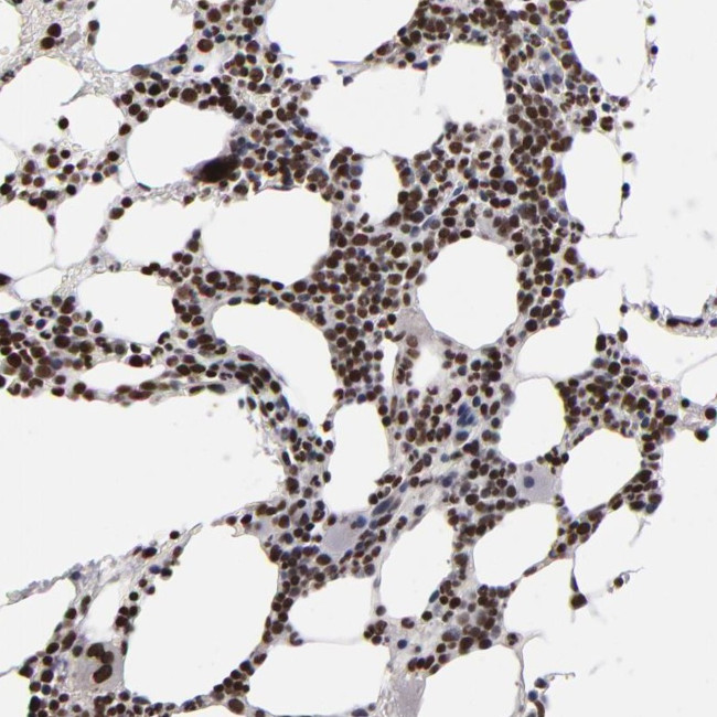 KDM6A Antibody in Immunohistochemistry (IHC)