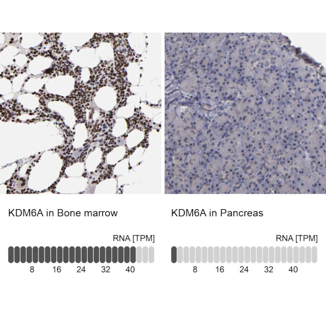 KDM6A Antibody