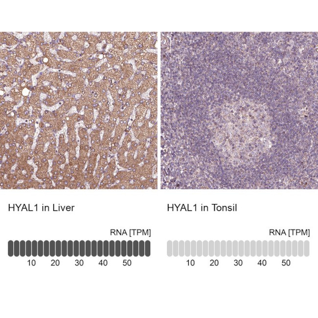 HYAL1 Antibody in Immunohistochemistry (IHC)