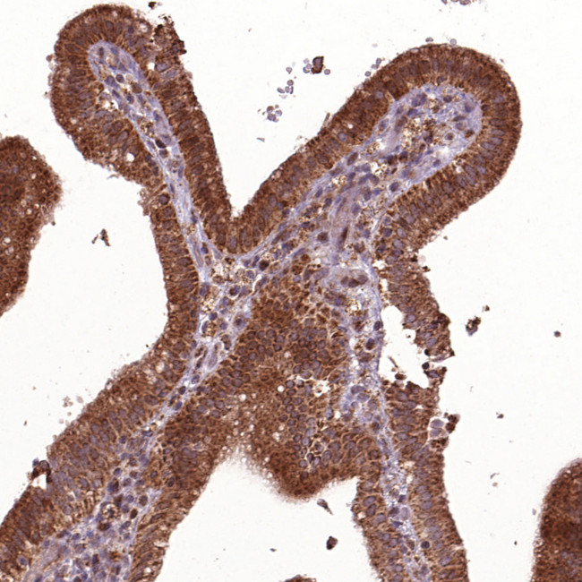 HYAL1 Antibody in Immunohistochemistry (IHC)