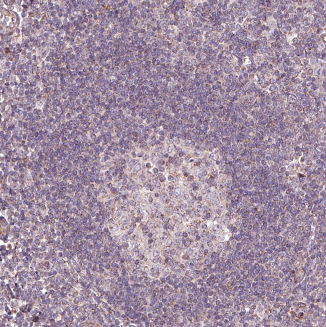 HYAL1 Antibody in Immunohistochemistry (IHC)