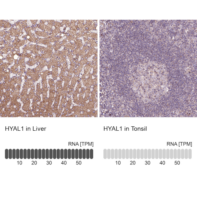 HYAL1 Antibody