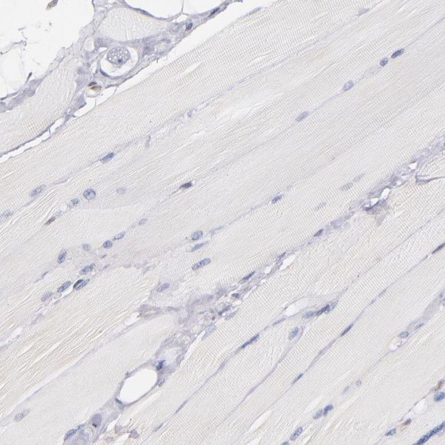 IFI16 Antibody in Immunohistochemistry (IHC)