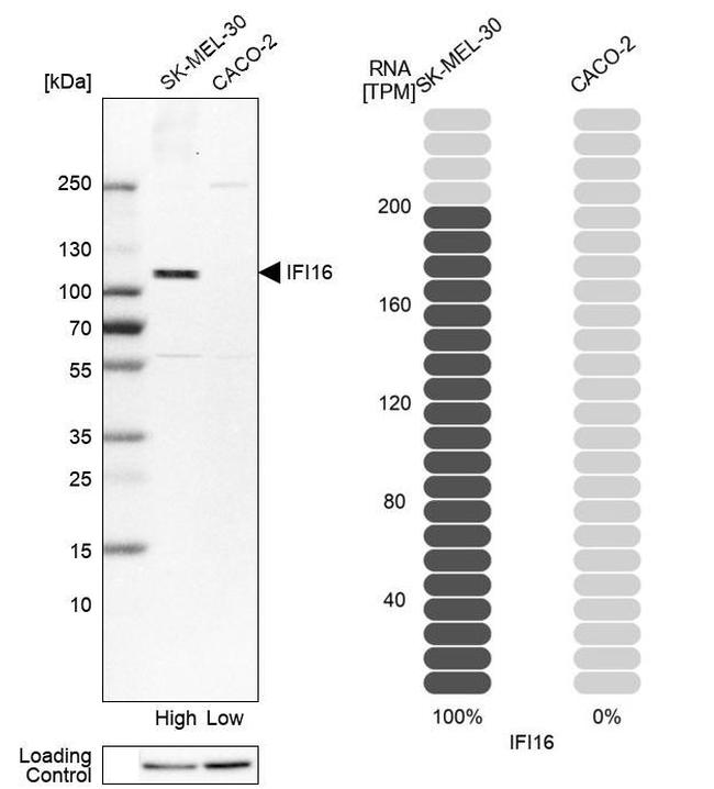 IFI16 Antibody in Western Blot (WB)