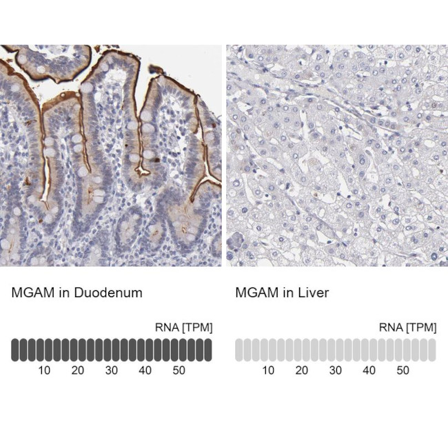 MGAM Antibody in Immunohistochemistry (IHC)