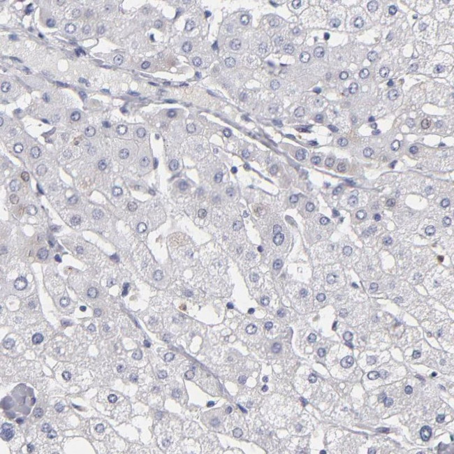 MGAM Antibody in Immunohistochemistry (IHC)