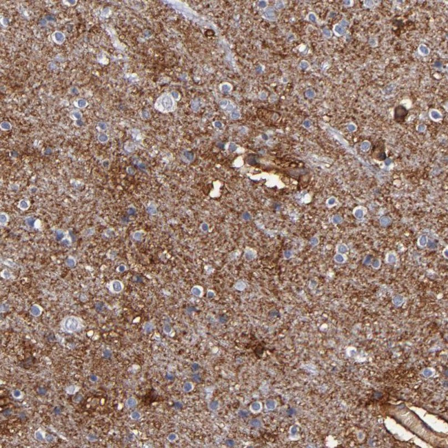 PLSCR4 Antibody in Immunohistochemistry (IHC)