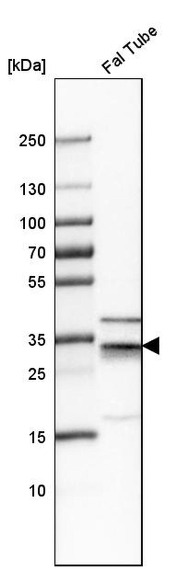 PLSCR4 Antibody in Western Blot (WB)