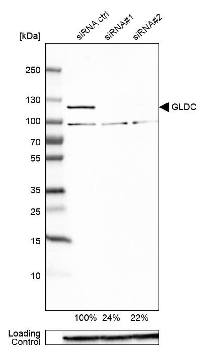 GLDC Antibody in Western Blot (WB)